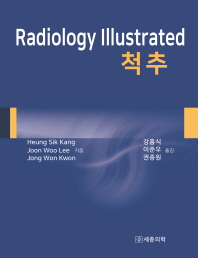Radiology Illustrated: 척추(양장본 HardCover)